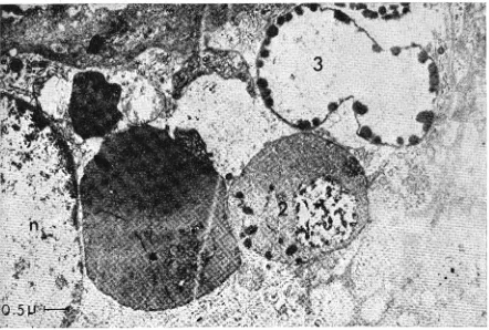 Fig. 3- Electron micrograph of red bodies attached to the membrane. and destruction. Blood cells containing Heinz bodies in the spleen