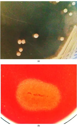 Figure 2.  (a) Colony morphology and (b) zone of hydrolysis of bacterial isolate NAB37 