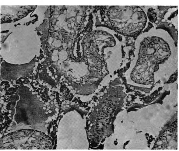 Fig. I-Normal of the control group. X testicular tissue, with normal spermatogenesis from animals 400 (Trichrome staining technique)