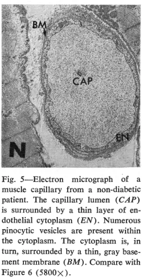 Fig. 6-Electron micrograph of a muscle capillary from a diabetic pa-tient. The capillary lumen (CAP) is surrounded by several endothelial cells
