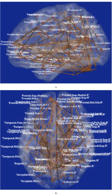 Figure 3.  Brain connectivity map of top-predictive features obtained through RCE-SVM classification with Pearson’s correlation coefficient (PCC) feature: A