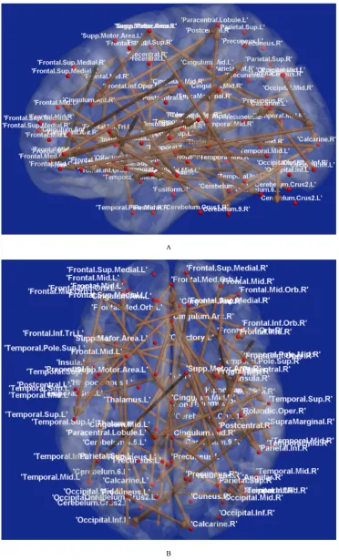 Figure 4.  Brain connectivity map of top-predictive features obtained through RCE-SVM classification with partial correlation (PC) features: A