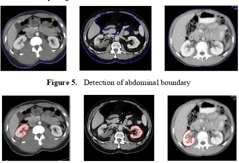 Figure 5.  Detection of abdominal boundary 