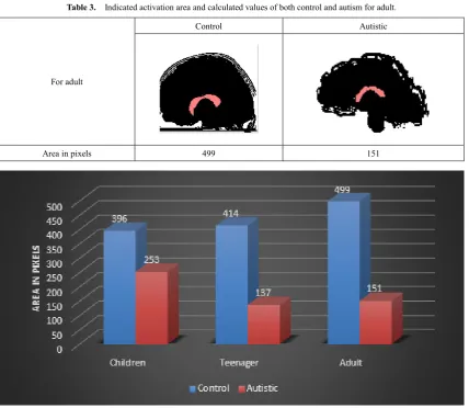 Table 3.  Indicated activation area and calculated values of both control and autism for adult