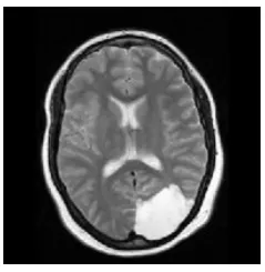Fig.3: Acquired Brain MRI image  