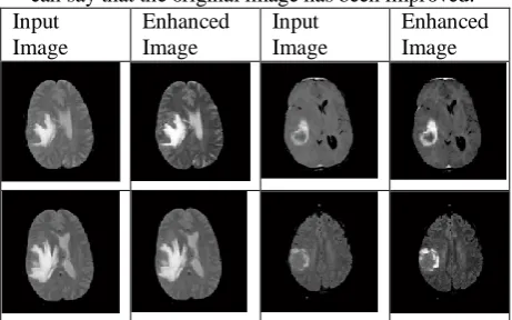 Fig 7.1: Skull Removal from MRI Images.  