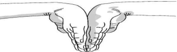 Gambar 3. Tes Phalen (Urbano, 2000)  