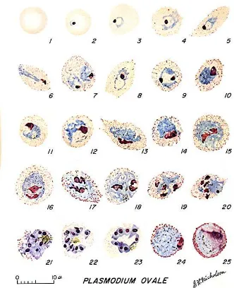Gambar 10. Morfologi Plasmodium ovale, 1: eritrosit normal, 2-5: trofozoit muda (ring-stage), 6-15: trofozoit, 16-23: skizon, 24: makrogametosit, 25: mikrogametosit (Diagnostic Findings Malaria, 2009)