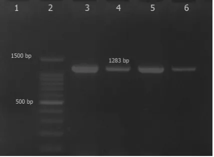 Fig. 3. Agarose gel electrophoresis of the PCR products for lane 9 and 10, 6 and 8 negative and positive controls for isolates, Lanes 1 and 3 negative and positive controls for clfdetection of clfA, clfB, cna and spa gene of some S