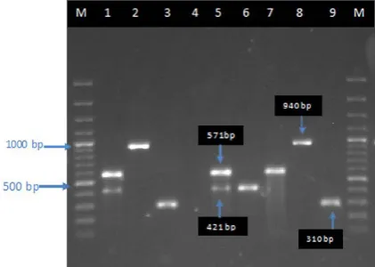 Table 2. Distribution of resistance phenotypes of MLSB based on the studied genes (mecA, ermA, ermC and msrA)