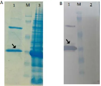 Fig. 3. SDS-PAGE and Western blot analysis of the recombinant protein expression at different times: (A) Lane M, molecular weight marker,Lane1, BL 21; Lane  2, 0 time; Lane 3, 3h after induction