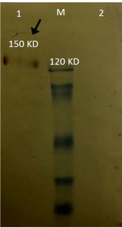 Fig. 5. Western blot analysis of  the purified fH protein by affinity chromatography: Lane M, molecular weight marker, Lane 1, purified factor H protein