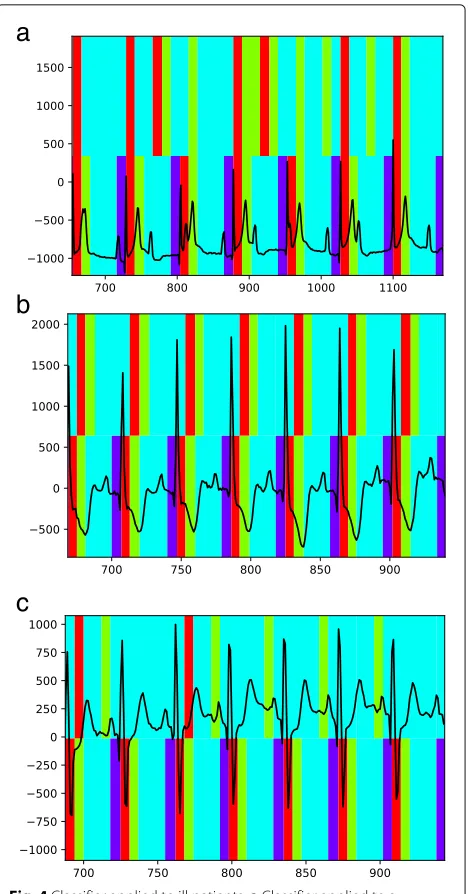 Fig. 4 Classifier applied to ill patients. a Classifier applied to adysrthythmia patient, b Classifier applied to a valvular-heart-diseasepatient, c Classifier applied to a myocardial-infarction patient
