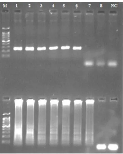 Fig. 3. Sensitivity of PCR (above) and LAMP (below) 10 assays. Agarose gel electrophoresis of LAMP products from 10-fold serially diluted construct plasmid PTZ57R
