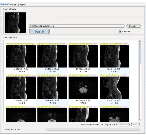 Fig. 4 Best retrieved brain MRI images 