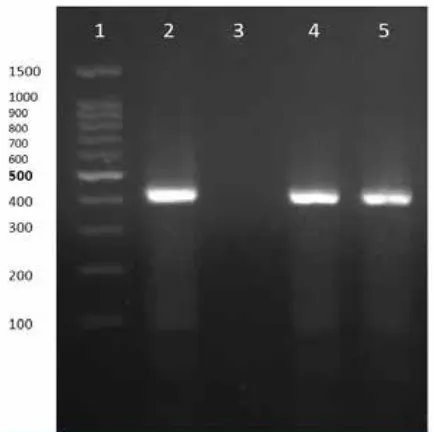 Fig. 1. PCR test for Lane 1) DNA LadderLane 2) PCR positive controlLane 3) negative control Lanes 4 and 5) positive PCR tests, (positive PCR products Ureaplasma urealyticum detection