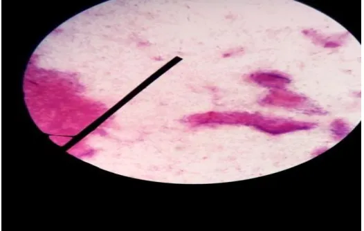 Gambar 1. Mikroskopis Salmonella typhi 