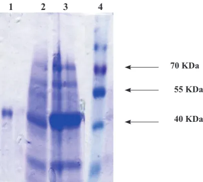 Fig. 2. Western blot analysis of recombinant TcpA: constructed vector pGEX4T1-TcpA, lane 3: serum of patient recovered from cholera, lane 4: serum of rabbit immunized with purified recombinant TcpA protein, lane 5: lane 1: protein marker (Fermentas) , lane