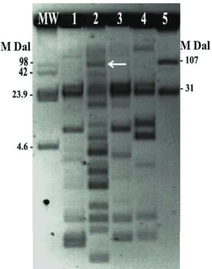 Fig. 1. Plasmid patterns of the Shigella clinical isolates 