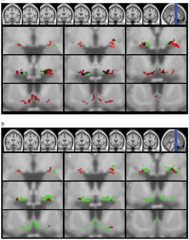 Fig. 2.Volumetric changes projected onto the BFCS mask. Coronal section through the basal