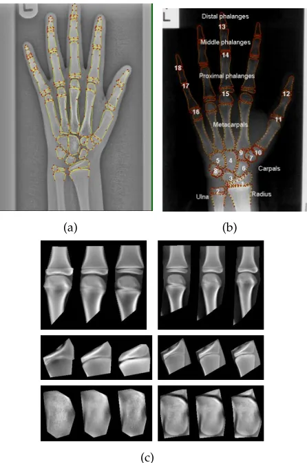 Fig. 1. (a) Radiograph with manually annotated points. (b) BoneAge growth points based on TW method