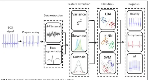 Fig. 1 Block diagram of the segmentation and classification of ECG signals