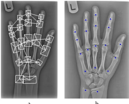 Fig. 3.(a) A part and geometry model, (b) Resultingpoints from the model superimposed on a hand radio-graph.