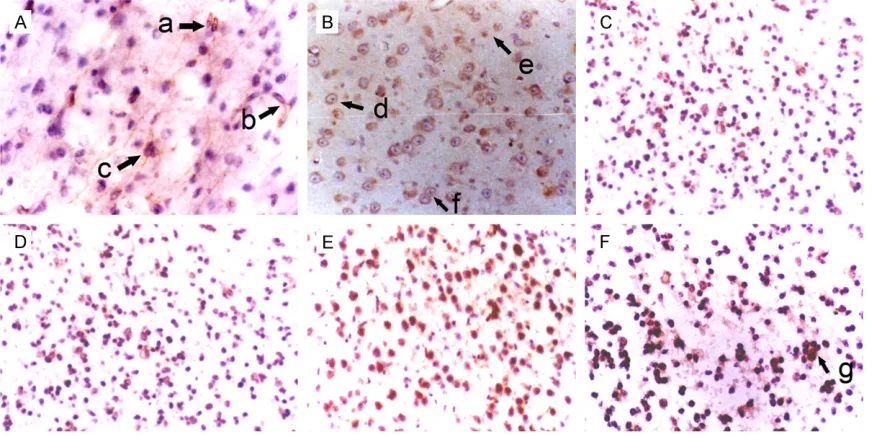 Figure 1. Morphology of NSCs in the hippocampus of fetuses with different gestational age (SABC, DAB staining, ×200)