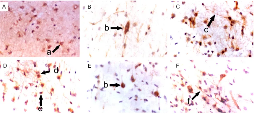 Figure 2. Morphology of NSCs in the subventricular zone of fetuses with different gestational age (SABC, DAB stain-ing, ×400)