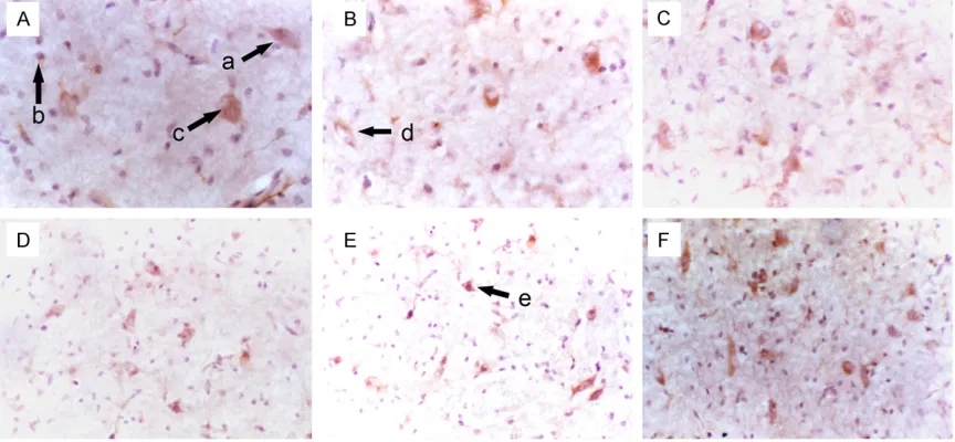 Figure 3. Morphology of NSCs in the striatum of fetuses with different gestational age (SABC, DAB staining, A-C: ×400; D-F: ×200)
