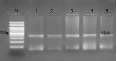 Figure 1) Agarose gel electrophoresis of mecA gene PCR product. Lane M: The 100bp DNA marker