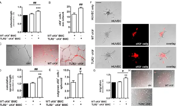Figure 1. Bone marrow-derived cKitoutgrowth of endothelial cells from collagen-embedded HUVEC spheroids and (E) enhanced migration of TLR2co-incubation with WT cKitsentative spheroids exhibiting HUVEC tubular sprouts (translucent) and migrated cKit+ cells 