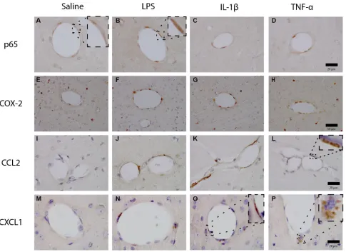 Figure 9.  activated endothelium. Scale bars are 20µm and 50µm as shown.LPS (100µg/kg), IL-1β (15µg/kg) or TNF-α (50µg/kg)