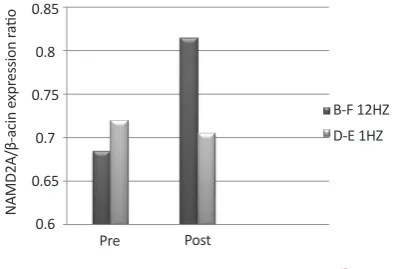 Table 2. Changes in the volume of the left hippocampus after radiation with 1 Hz (D-E) and 12 Hz (B-F) 
