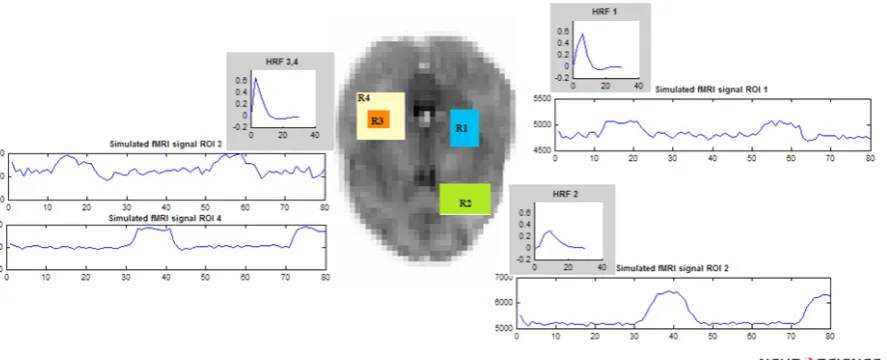 Figure 2. Synthetic fMRI dataset for parcellation: 4 different regions (R1, R2, R3, and R4) are specified in the brain