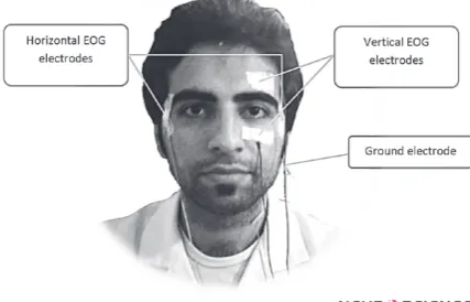 Figure 3. Configuration of electrodes on a subject’s face for EOG signal acquisition.
