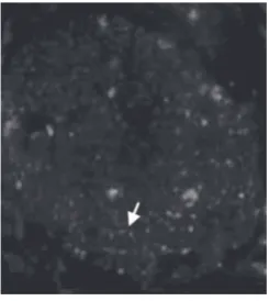Figure 2. Cross-section of the sci-atic nerve, 4 weeks after the trans-plantation of BMSCs labeled with anti BrdU antibody shown as red spots in the sciatic nerve (arrow) (×100)