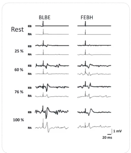 Figure 4. Normalized group mean patterns of facilitation of MEPs at different levels of voluntary activation in the right ES muscle (4A, upper panel), and in the right RA muscle (4B, upper panel); Same data presented in a way to better visualise task diffe