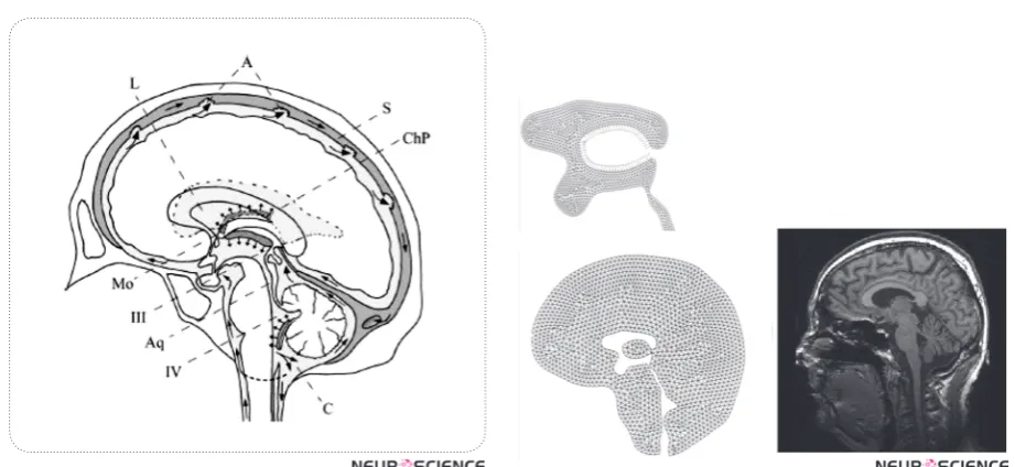 Figure 2. (a) Brain tissue geometry with finite-element mesh-ing, (b) Brain MRI scan of  the volunteer.