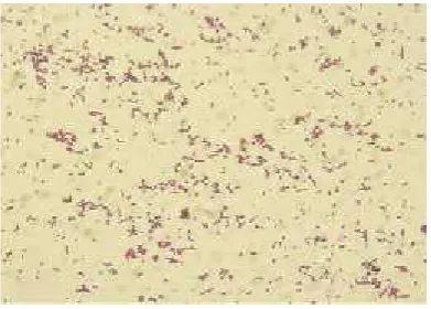 Gambar 2. Bakteri Streptococcus iniae