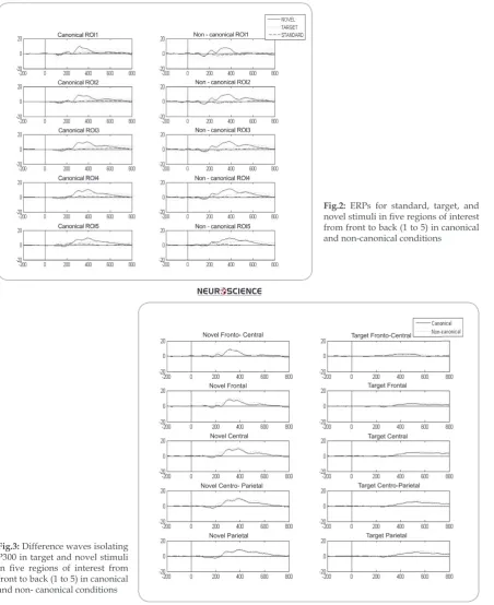 Fig.2: ERPs for standard, target, and 
