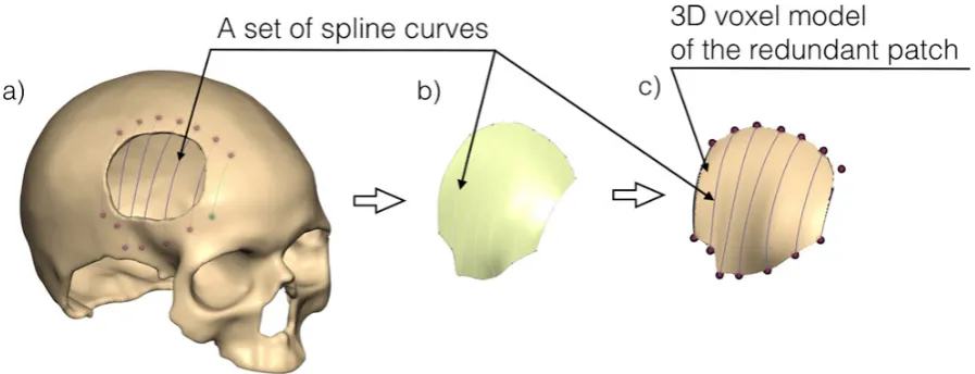 Fig. 17. Views of next modeling stages: a) inner surface of the skull hole, b) adding new additional layer (upon realization), c) well-fitting cranial implant model into the skull model
