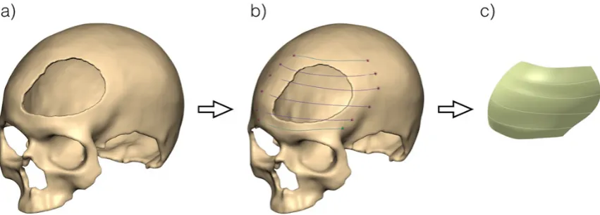 Fig. 12. The skull bone voxel model and the surface spline curves