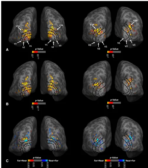 Figure 2.Activity evoked by depth-varying RDS stimuli within the occipital visual cortex of two individual subjects (shown on left and right, respectively), each overlaid on their own inflatedfar-preferring(redtoyellow)clusterscanalsobefoundindifferentvisu