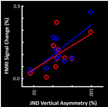 Figure 5.The amount of vertical asymmetry in global visual processing is associated withthe level of depth-sensitive fMRI activity evoked within area V3A