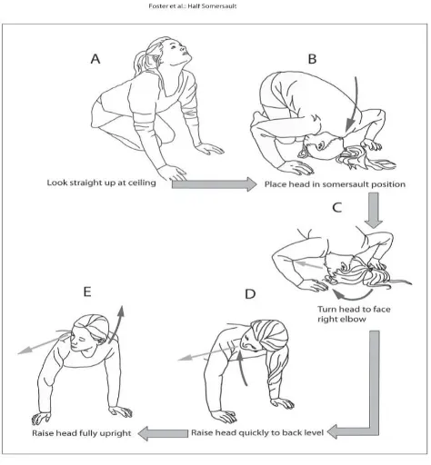 Fig 13 : Half somersault exercise or foster maneuver(84) 