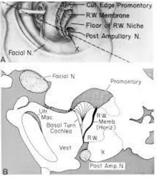 Fig 14: Landmark of posterior ampullary nerve(89) 