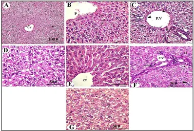 Fig. 1: Photomicrographs of a section of liver of nursing mother at 21th day of lactation