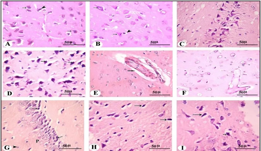 Fig. 4: Photomicrographs of a section of brain (cerebellum) of nursing mother at 21th day of lactation