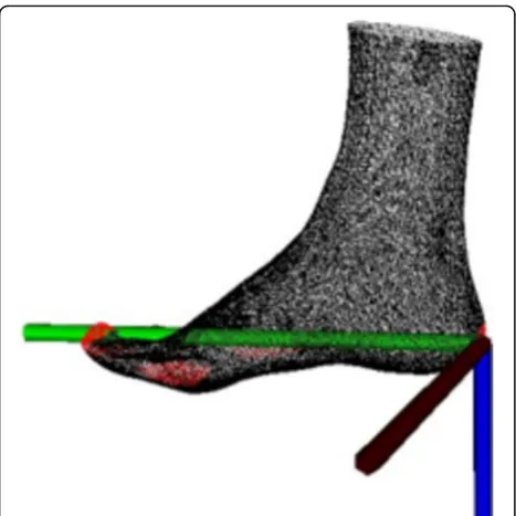 Fig. 4 Comparison of 3D reconstruction effect of foot shape